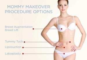 mommy makeover procedure options infographic