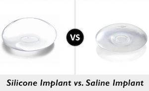 silicone vs saline implants infographic showing implants
