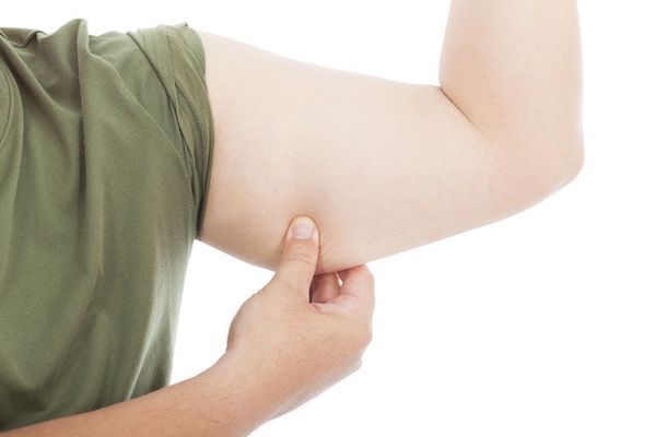 Patient pinching excess fat and tissue hanging from the upper arm