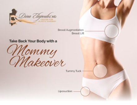 Mommy Makeover Boston