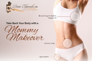 Get Your Body Back With a Mommy Makeover — MA