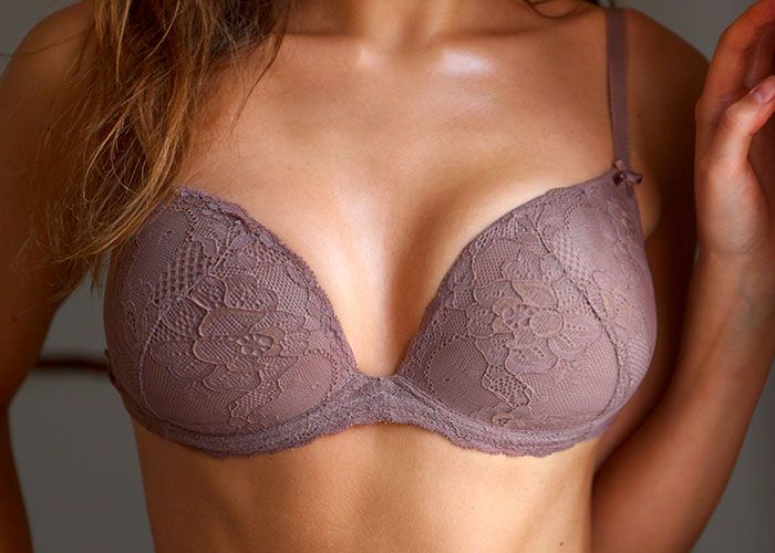 Woman's bust after breast lift