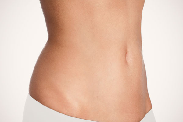 Liposuctions by Dina MD in Massachusetts